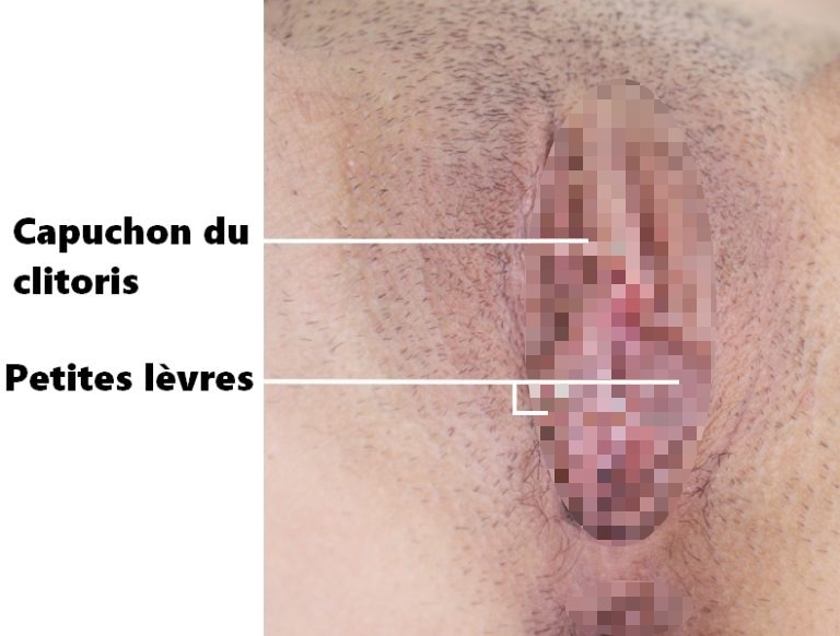 Le capuchon du clitoris est une zone à masser