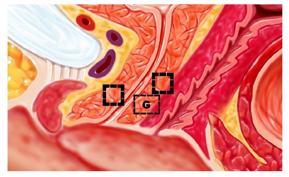 Le point G et le tissu para-urétral (image)