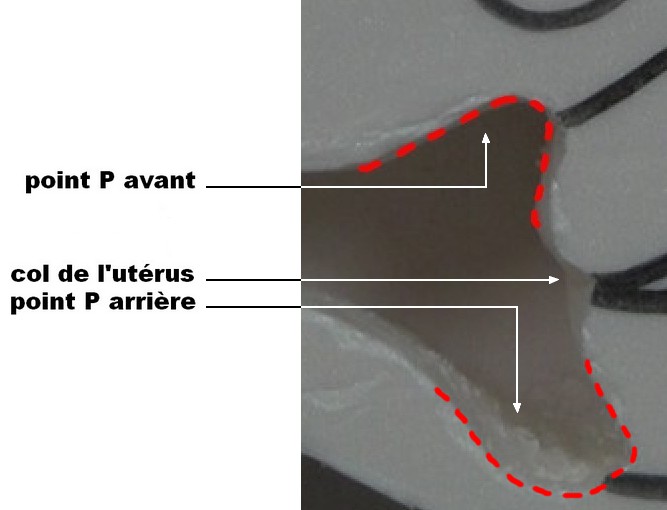 Les back et front deep spots en image